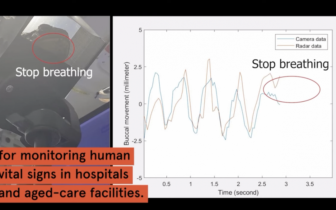 Remote patient monitoring